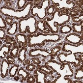 Anti-CSN3 antibody produced in rabbit Prestige Antibodies&#174; Powered by Atlas Antibodies, affinity isolated antibody