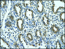 Anti-MMP1 IgG fraction of antiserum