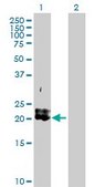 Anti-PDGFA antibody produced in rabbit purified immunoglobulin, buffered aqueous solution