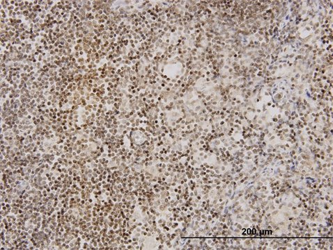 Monoclonal Anti-TNKS antibody produced in mouse clone 1A2, purified immunoglobulin, buffered aqueous solution