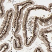 Anti-RBM25 antibody produced in rabbit Prestige Antibodies&#174; Powered by Atlas Antibodies, affinity isolated antibody, buffered aqueous glycerol solution