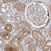 Anti-FGFR4 antibody produced in rabbit Prestige Antibodies&#174; Powered by Atlas Antibodies, affinity isolated antibody, buffered aqueous glycerol solution