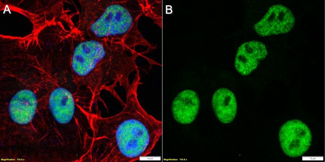 Anti-SV40 T Antigen Antibody, clone PAb416 ZooMAb&#174; Mouse Monoclonal recombinant, expressed in HEK 293 cells