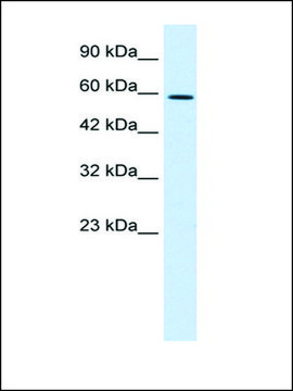 Anti-TBX4 antibody produced in rabbit affinity isolated antibody