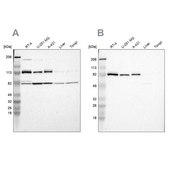 Anti-CARS antibody produced in rabbit Prestige Antibodies&#174; Powered by Atlas Antibodies, affinity isolated antibody, buffered aqueous glycerol solution
