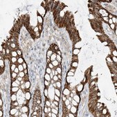 Anti-ETHE1 antibody produced in rabbit Prestige Antibodies&#174; Powered by Atlas Antibodies, affinity isolated antibody, buffered aqueous glycerol solution, ab2