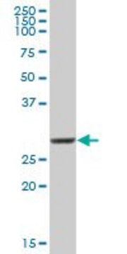 Anti-COMT antibody produced in mouse purified immunoglobulin, buffered aqueous solution
