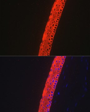 Anti-Cytokeratin 12 (KRT12) Antibody, clone 2M1K10, Rabbit Monoclonal