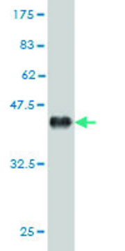 Monoclonal Anti-EPHB6 antibody produced in mouse clone 3B6, purified immunoglobulin, buffered aqueous solution