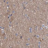 Anti-ASCC3 antibody produced in rabbit Prestige Antibodies&#174; Powered by Atlas Antibodies, affinity isolated antibody, buffered aqueous glycerol solution, ab3