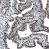 Monoclonal Anti-ATF3 antibody produced in mouse Prestige Antibodies&#174; Powered by Atlas Antibodies, clone CL1685, purified immunoglobulin, buffered aqueous glycerol solution