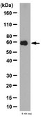 Anti-Cholesterol acyltransferase 1 Antibody from rabbit, purified by affinity chromatography