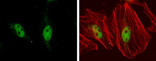 Monoclonal Anti-TEF1 antibody produced in mouse clone GT13112, affinity isolated antibody