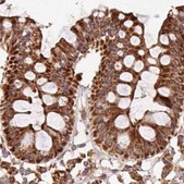 Anti-ATP5A1 antibody produced in rabbit Prestige Antibodies&#174; Powered by Atlas Antibodies, affinity isolated antibody, buffered aqueous glycerol solution