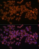 Anti-Fatty Acid Synthase (FASN) antibody produced in rabbit