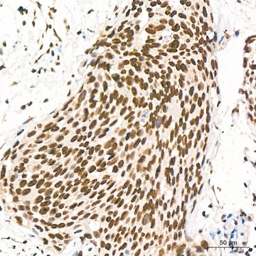 Anti-UBE2B Antibody, clone 2Z3R2, Rabbit Monoclonal