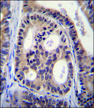 ANTI-CYTSA (N-TERM) antibody produced in rabbit IgG fraction of antiserum, buffered aqueous solution