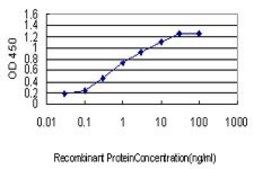 Monoclonal Anti-S100A2 antibody produced in mouse clone M2, purified immunoglobulin, buffered aqueous solution