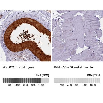 Anti-WFDC2 antibody produced in rabbit Prestige Antibodies&#174; Powered by Atlas Antibodies, affinity isolated antibody, buffered aqueous glycerol solution