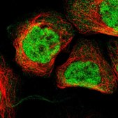 Anti-ZNF512B antibody produced in rabbit Prestige Antibodies&#174; Powered by Atlas Antibodies, affinity isolated antibody, buffered aqueous glycerol solution