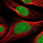 Anti-ZBTB43 antibody produced in rabbit Prestige Antibodies&#174; Powered by Atlas Antibodies, affinity isolated antibody, buffered aqueous glycerol solution