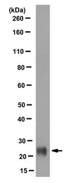 Anti-VSNL1 Antibody, clone 2D11 clone 2D11, from mouse