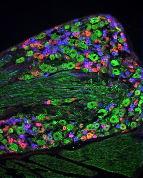 Anti-Neurofilament 160/200 antibody, Mouse monoclonal ~2&#160;mg/mL, clone RMdO20, purified from hybridoma cell culture