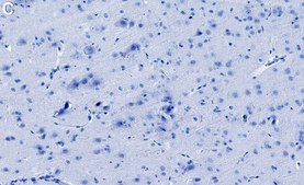 Anti-CACNG8/TARP γ8 Antibody, clone 1K4 ZooMAb&#174; Rabbit Monoclonal recombinant, expressed in HEK 293 cells