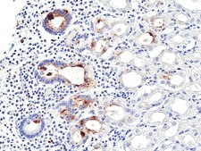 Anti-Helicobacter Pylori (H.Pylori) Rabbit Monoclonal Antibody clone RM429, affinity purified immunoglobulin