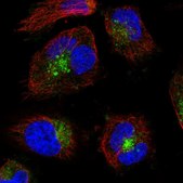 Anti-VAMP7 antibody produced in rabbit Prestige Antibodies&#174; Powered by Atlas Antibodies, affinity isolated antibody, buffered aqueous glycerol solution