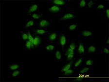 Monoclonal Anti-UBE3A antibody produced in mouse clone 2F6, purified immunoglobulin, buffered aqueous solution