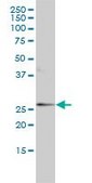 Monoclonal Anti-ORM1 antibody produced in mouse clone 2F9-1F10, purified immunoglobulin, buffered aqueous solution