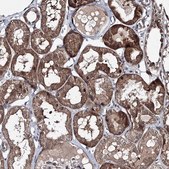 Anti-RANBP3L antibody produced in rabbit Prestige Antibodies&#174; Powered by Atlas Antibodies, affinity isolated antibody, buffered aqueous glycerol solution