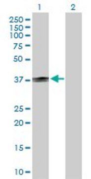 Anti-CD1B antibody produced in rabbit purified immunoglobulin, buffered aqueous solution