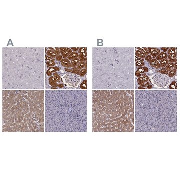 Anti-PAH antibody produced in rabbit Prestige Antibodies&#174; Powered by Atlas Antibodies, affinity isolated antibody, buffered aqueous glycerol solution