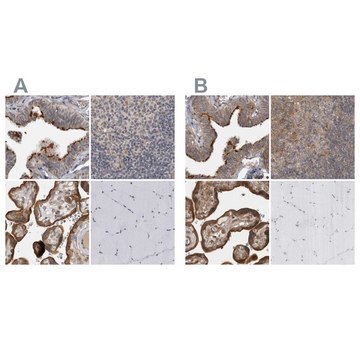 Anti-LRRC45 antibody produced in rabbit Prestige Antibodies&#174; Powered by Atlas Antibodies, affinity isolated antibody, buffered aqueous glycerol solution