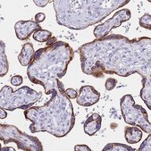Anti-GAA antibody produced in rabbit Prestige Antibodies&#174; Powered by Atlas Antibodies, affinity isolated antibody, buffered aqueous glycerol solution