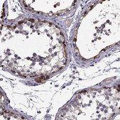 Anti-SCNN1D antibody produced in rabbit Prestige Antibodies&#174; Powered by Atlas Antibodies, affinity isolated antibody, buffered aqueous glycerol solution