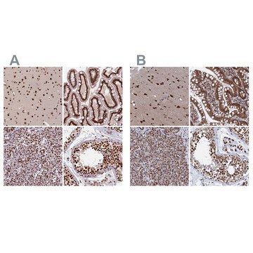 Anti-CTB-50L17.10 antibody produced in rabbit Prestige Antibodies&#174; Powered by Atlas Antibodies, affinity isolated antibody, buffered aqueous glycerol solution