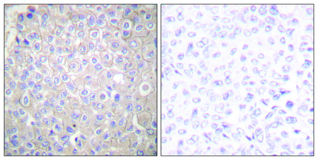 Anti-E-cadherin antibody produced in rabbit affinity isolated antibody