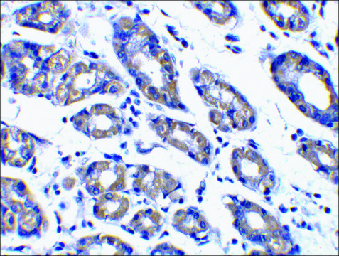 Anti-NOXA antibody produced in rabbit affinity isolated antibody, buffered aqueous solution