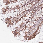 Anti-CHURC1 antibody produced in rabbit Prestige Antibodies&#174; Powered by Atlas Antibodies, affinity isolated antibody, buffered aqueous glycerol solution