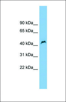 Anti-PNPLA1 antibody produced in rabbit affinity isolated antibody