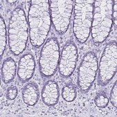 Anti-CCDC39 antibody produced in rabbit Prestige Antibodies&#174; Powered by Atlas Antibodies, affinity isolated antibody, buffered aqueous glycerol solution