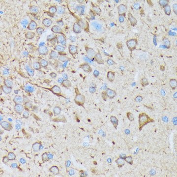 Anti-CaMKII Antibody, clone 7L9F0, Rabbit Monoclonal