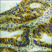 Anti-phospho-eIF2 &#945; (pSer51) antibody produced in rabbit affinity isolated antibody