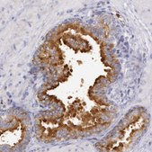 Anti-RAB27A antibody produced in rabbit Prestige Antibodies&#174; Powered by Atlas Antibodies, affinity isolated antibody, buffered aqueous glycerol solution