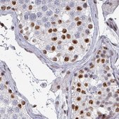 Monoclonal Anti-ADAR antibody produced in mouse Prestige Antibodies&#174; Powered by Atlas Antibodies, clone CL0176, purified immunoglobulin, buffered aqueous glycerol solution