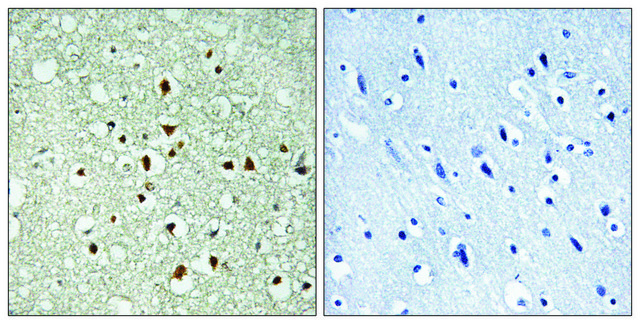 Anti-MAX antibody produced in rabbit affinity isolated antibody