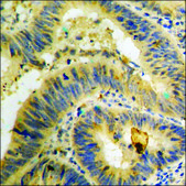 Anti-phospho-SGK (pSer422) antibody produced in rabbit affinity isolated antibody